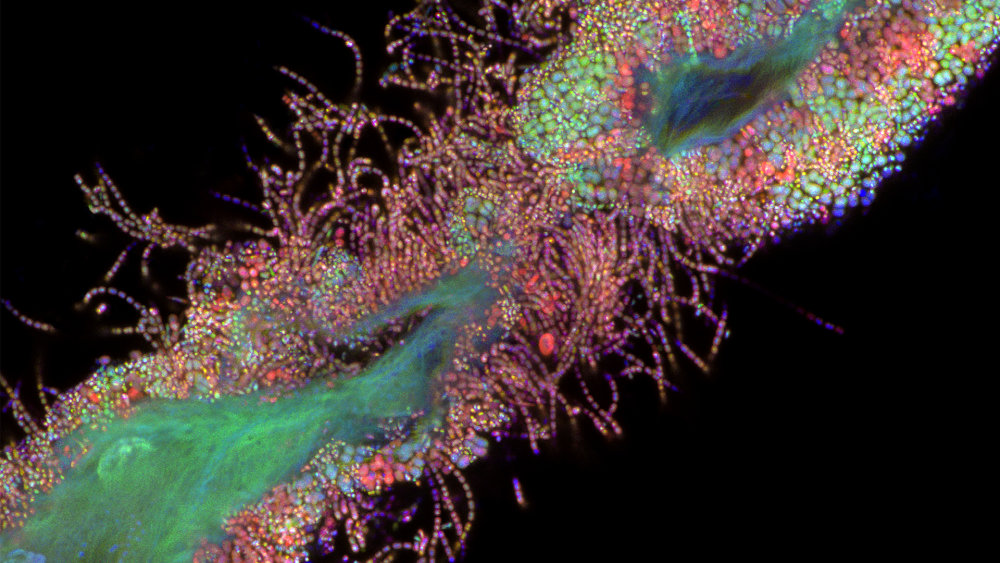 Preview image of Winner of 2022 ZEISS Microscopy Image Contest