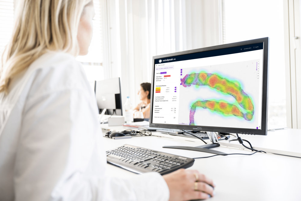 Preview image of ZEISS to invest in Mindpeak to accelerate AI-based digital pathology