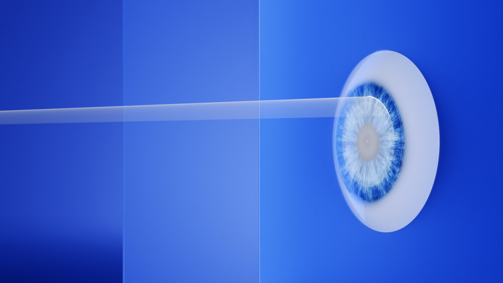 Preview image of ZEISS is shaping the market with the introduction of lenticule extraction for hyperopic patients, with or without astigmatism, using ZEISS VISUMAX 800.