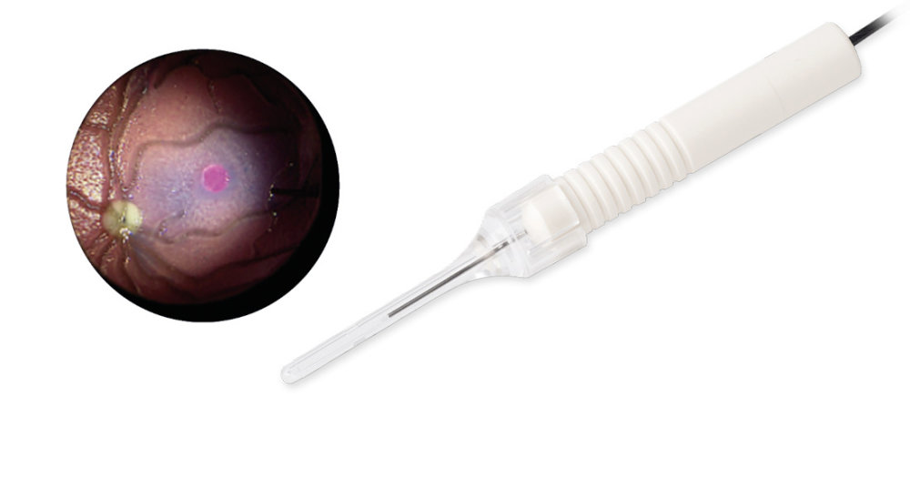 Preview image of dorc midlfield endoillumination-light