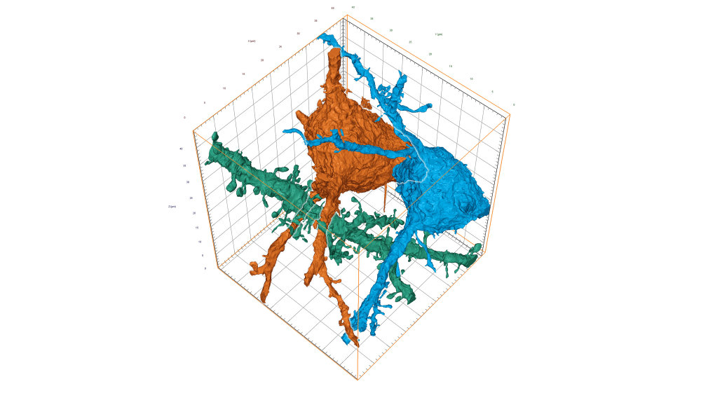 Preview image of neural tracing 3neurons