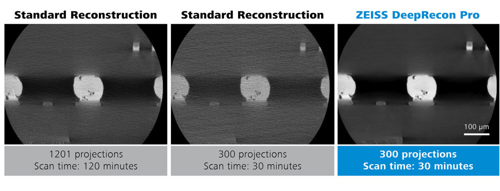 Preview image of ZEISS DeepRecon Pro