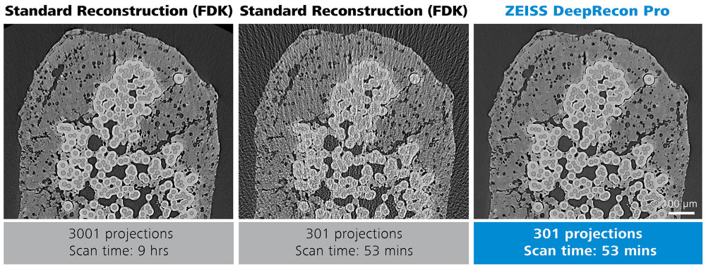 Preview image of ZEISS DeepRecon Pro