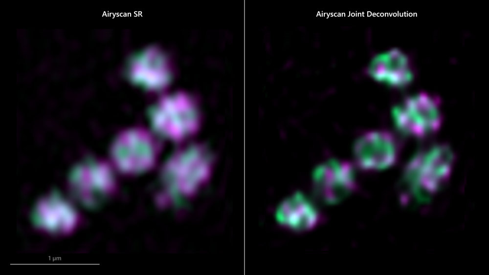 Vorschaubild von ZEISS Airyscan