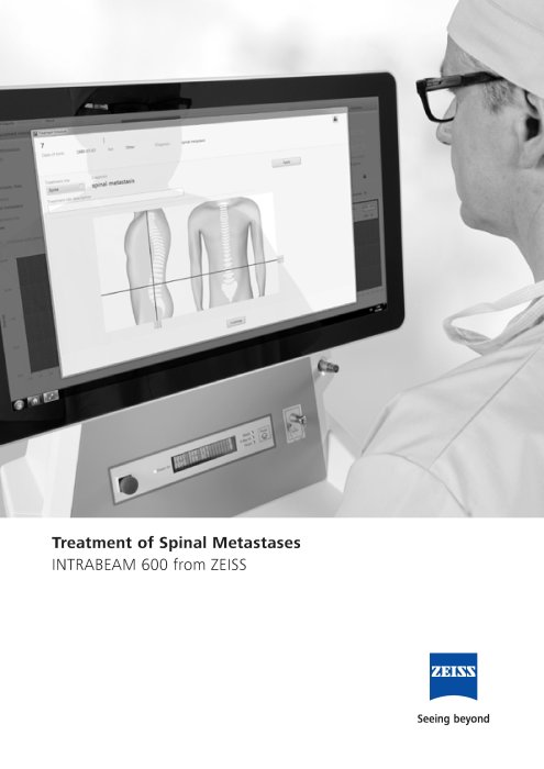 Preview image of INTRABEAM 600 Spine Application Brochure US