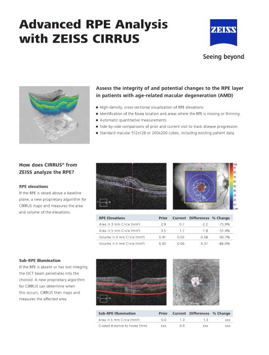 Preview image of CIRRUS Advanced RPE Analysis EN