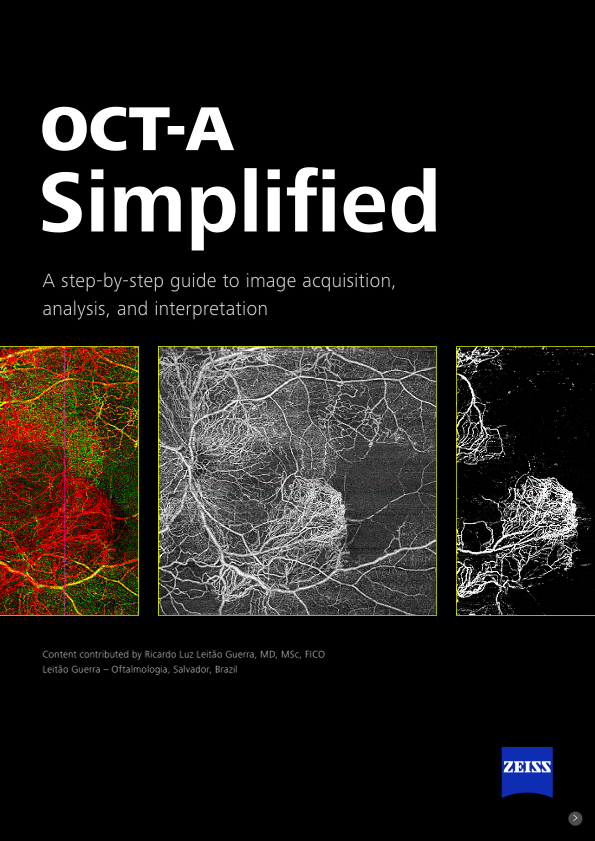 Preview image of OCT-A Simplified e-book US