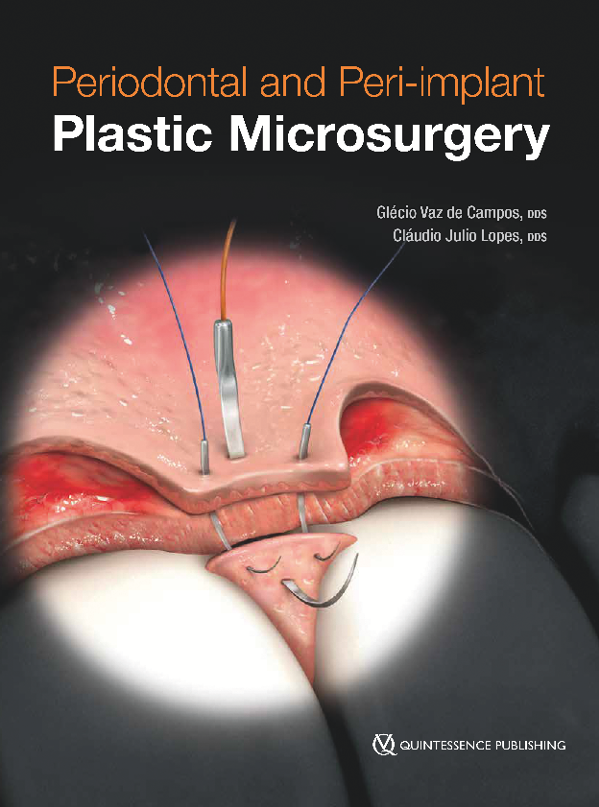 Preview image of Periodontal and Peri-implant - Plastic Microsurgery Book Chapter for Peer Insights EN