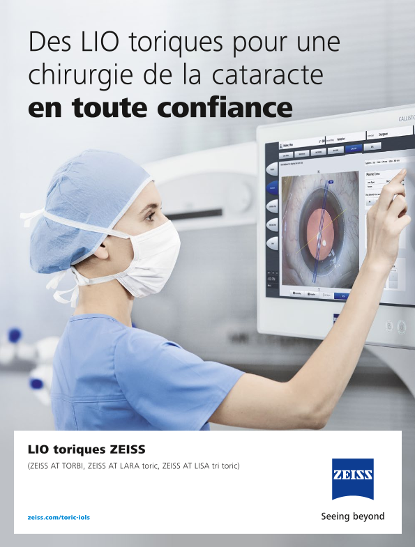 Image d’aperçu de Toric IOLs Brochure FR