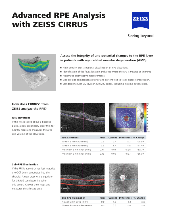 Preview image of CIRRUS Advanced RPE Analysis EN