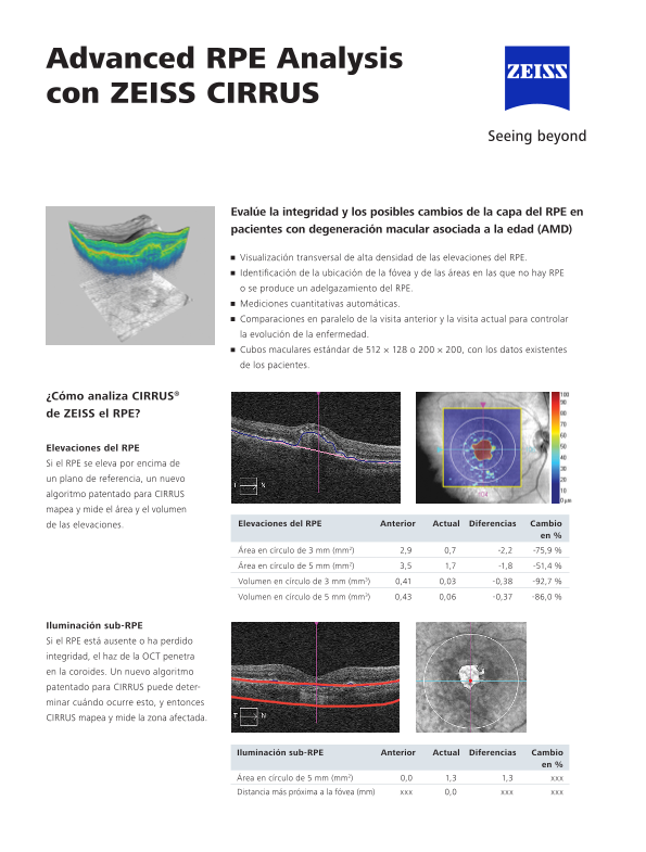 Vista previa de imagen de CIRRUS Advanced RPE Analysis ES