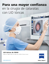 Vista previa de imagen de Toric IOLs Brochure ES