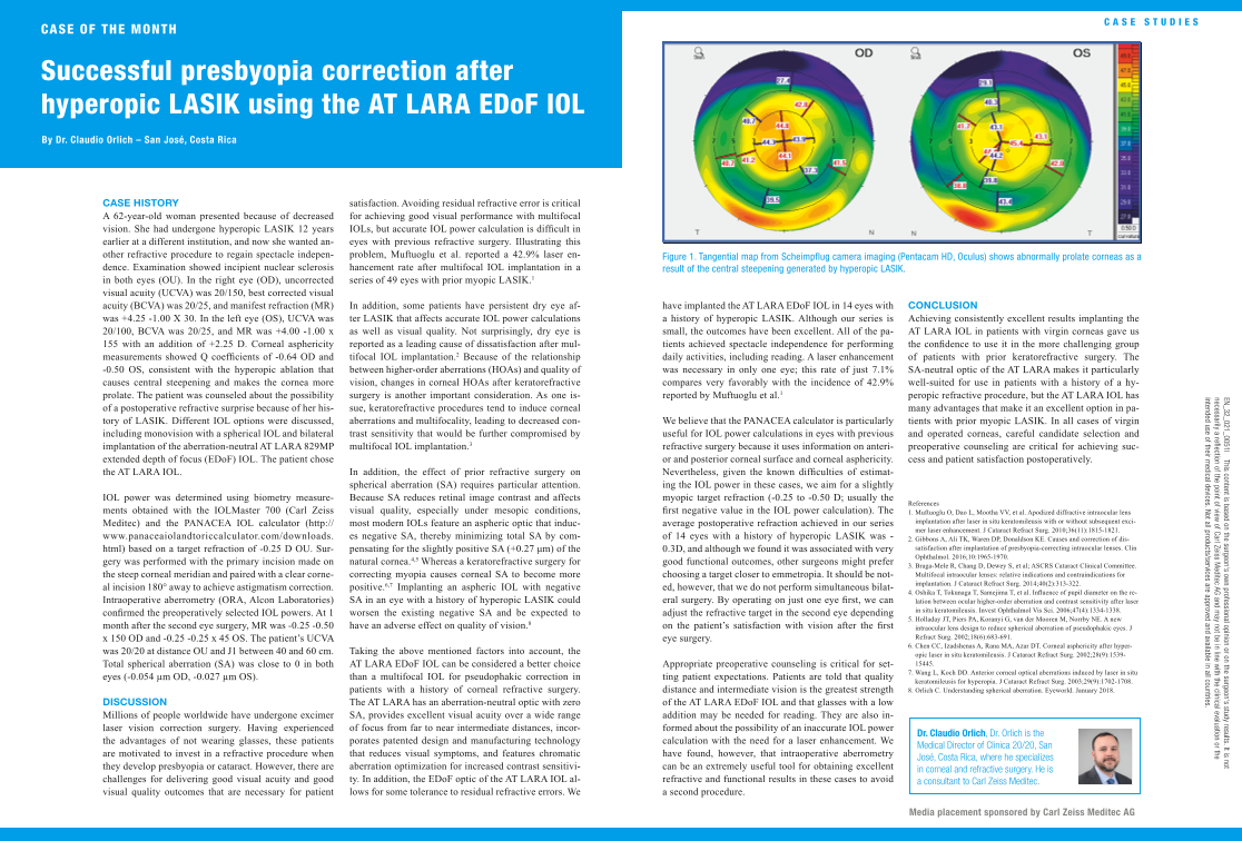 Anteprima immagine di AT LARA Case of the month EDoF IOL EN