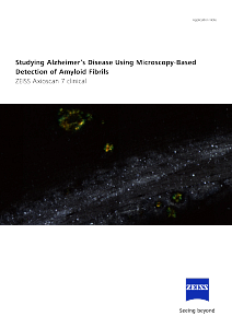 Preview image of Studying Alzheimer’s Disease Using Microscopy-Based Detection of Amyloid Fibrils