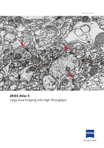 Image d’aperçu de ZEISS Atlas 5