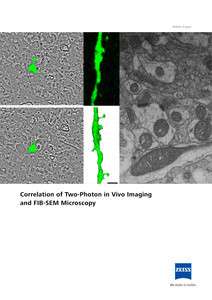 Preview image of Correlation of Two-Photon in Vivo Imaging and FIB-SEM Microscopy