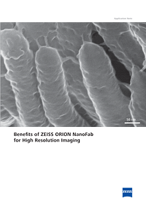 Image d’aperçu de Benefits of ZEISS ORION NanoFab for High Resolution Imaging