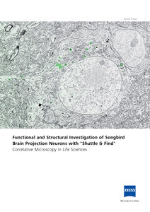 Image d’aperçu de Functional and Structural Investigation of Songbird Brain Projection Neurons with "Shuttle & Find"