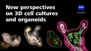 Image d’aperçu de New perspectives on 3D cell cultures and organoids