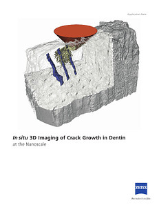 In situ  3D Imaging of Crack Growth in Dentinのプレビュー画像