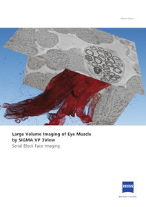 Vorschaubild von Large Volume Imaging of Eye Muscle by SIGMA VP and 3View
