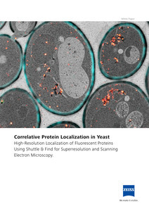 Image d’aperçu de Correlative Protein Localization in Yeast