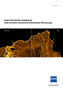 Vorschaubild von Super-Resolution Imaging by Dual Iterative Structured Illumination Microscopy