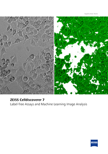 Preview image of ZEISS Celldiscoverer 7