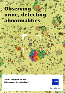 Your Compendium for Microscopy in Urinalysisのプレビュー画像