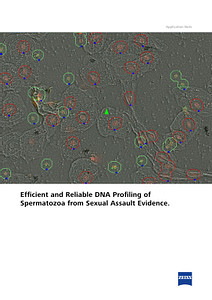Vorschaubild von Efficient and Reliable DNA Profiling of Spermatozoa from Sexual Assault Evidence.