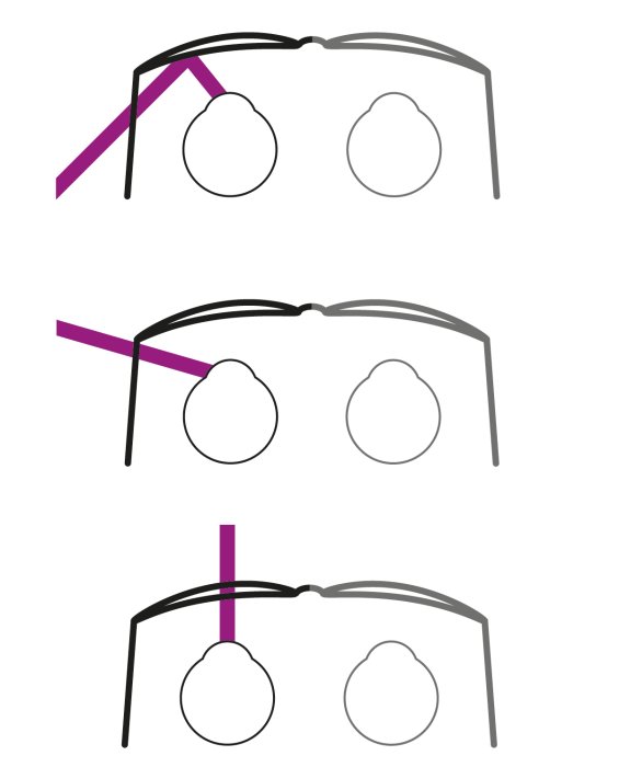 Preview image of Direct, transmitted UV radiation