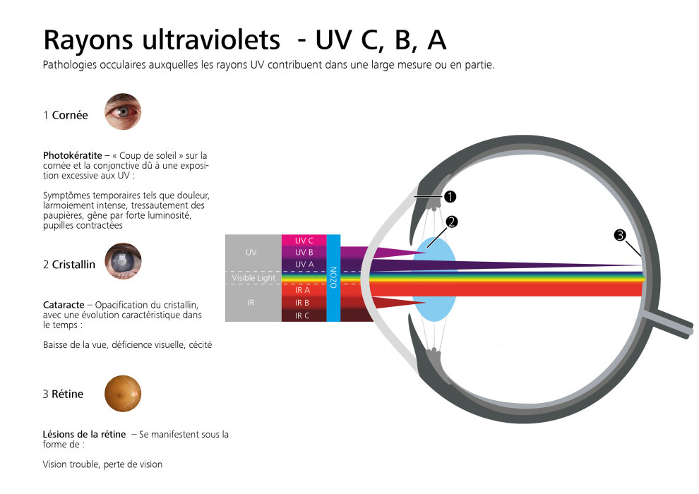 Image d’aperçu de ZEISS UVProtect